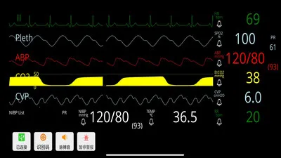 ģ��໤�����������ֻ���v1.0.2 �ٷ������ͼ2